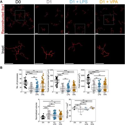 Valproic Acid Reduces Neuroinflammation to Provide Retinal Ganglion Cell Neuroprotection in the Retina Axotomy Model